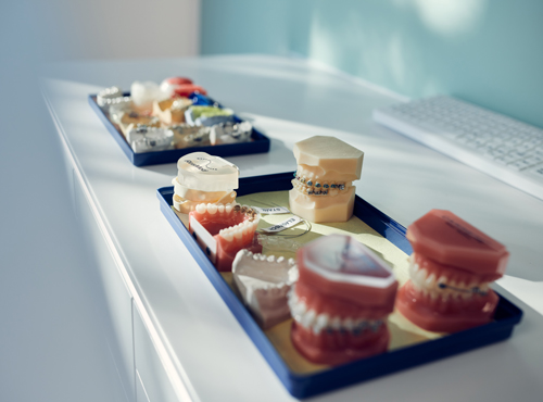 Behandlung Virtuelle 3D-Behandlungsplanung (Insignia) | Kieferorthopädische Fachzahnarztpraxis Dr. Schaurer in Mannheim