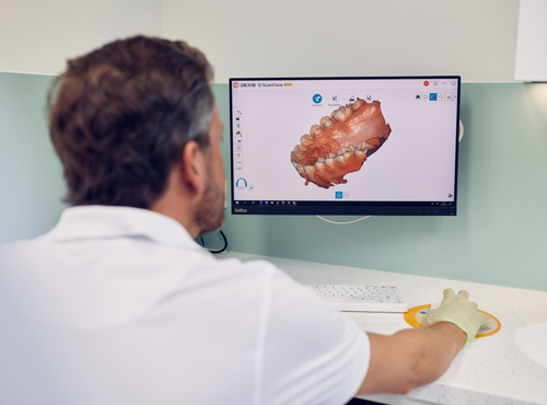 3D Scan